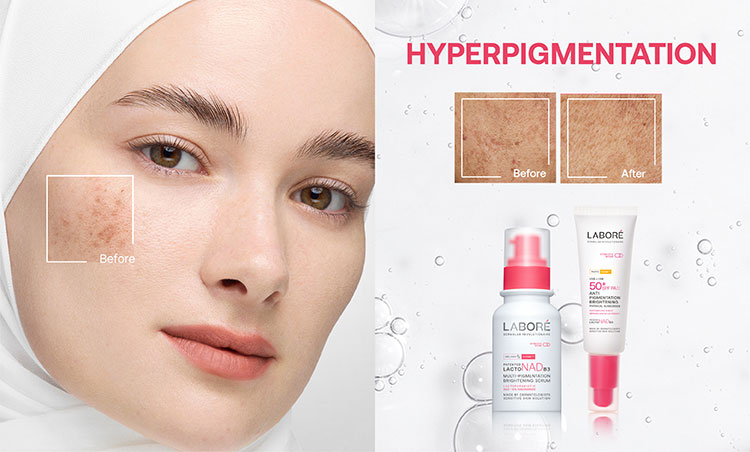 promo watsons labore image