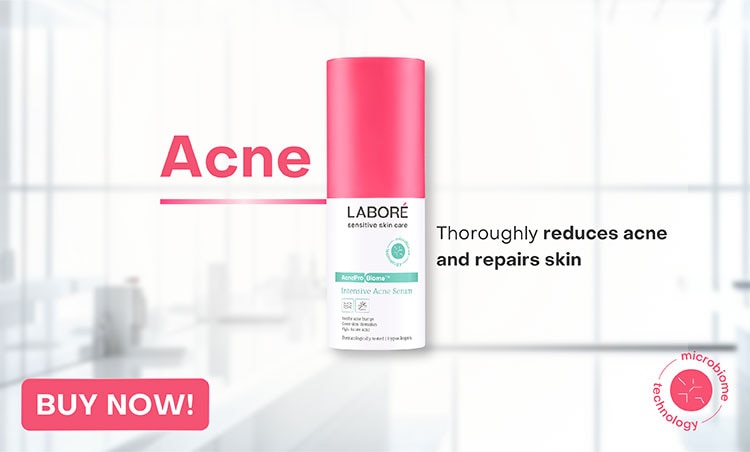 promo watsons labore